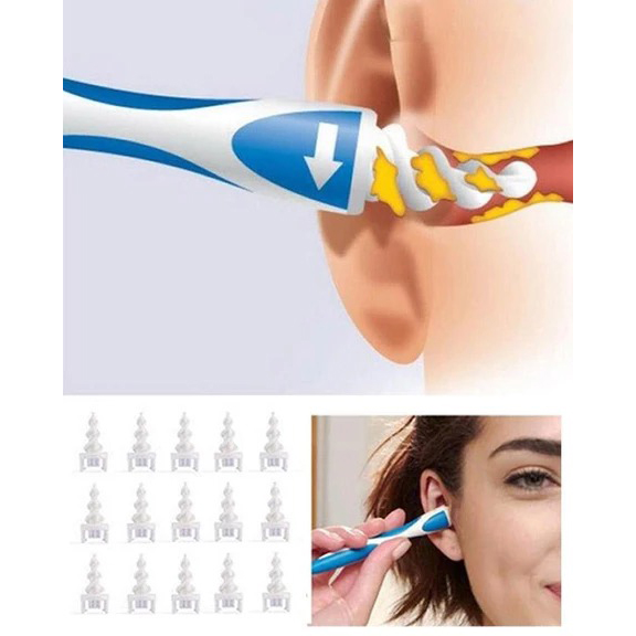 earwax-removal-soft-spiral-ear-cleaner