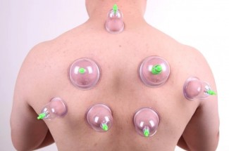 12pcs Hijama Cups Chinese Vacuum Cupping Kit for Muscle Relaxation and Therapy Price in Pakistan | LAPTAB