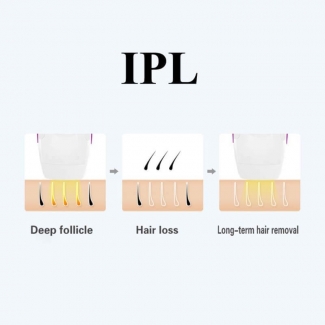 Umate IPL Hair Removal Laser Machine for Permanent, Painless At-Home Use Price in Pakistan | LAPTAB
