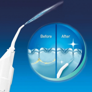 Power Floss Air Powered Dental Water Jet ? Cordless, Ergonomic Water Flosser for Braces and Hard-to-Reach Areas Price in Pakistan | LAPTAB