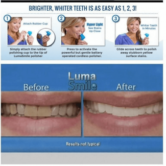 Dental Teeth Whitener and Stain Remover for Sensitive Teeth, Fast Results at Home Price in Pakistan | LAPTAB