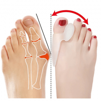 1 Pair Silicone Toe Separators for Hallux Valgus Relief and Toe Alignment Price in Pakistan | LAPTAB