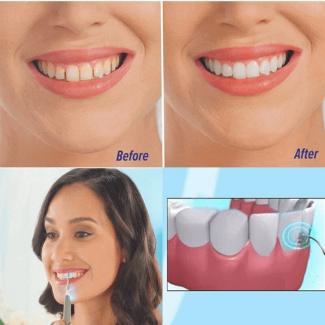 Sonic Dental Scalers Electric Teeth Whitener with LED Light and Silicone Flossing Tip Price in Pakistan | LAPTAB