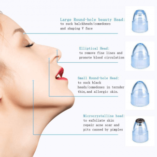 Electric Suction Blackhead Remover Pore Cleanser with 4 Power Modes, USB Rechargeable Price in Pakistan | LAPTAB
