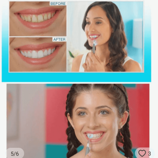 Sonic Pic Dental Cleaning System with Ultrasonic Pick and LED Light Price in Pakistan | LAPTAB
