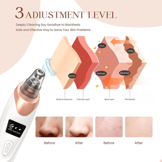Electric Blackhead Remover Pore Vacuum with 3 Suction Modes, USB Rechargeable Price in Pakistan | LAPTAB