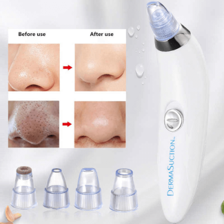DermaSuction Cell Operated Blackhead Remover with 4 Suction Heads Price in Pakistan | LAPTAB