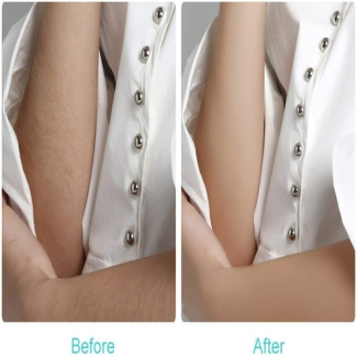 Instant and Pain Free Hair Removing Machine for Smooth Skin at Home Price in Pakistan | LAPTAB