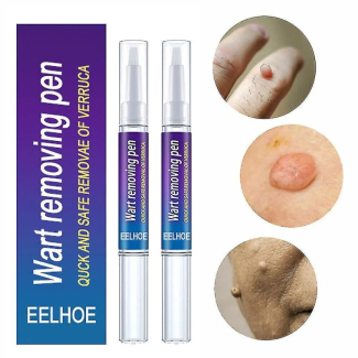 Warts Liquid Pen Woman Skin moles Remove Black Dots