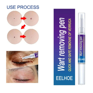 Warts Liquid Pen for Women - Effective Skin Mole and Black Dot Remover Price in Pakistan | LAPTAB