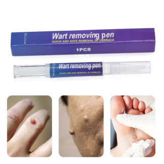 Warts Liquid Pen for Women - Effective Skin Mole and Black Dot Remover Price in Pakistan | LAPTAB