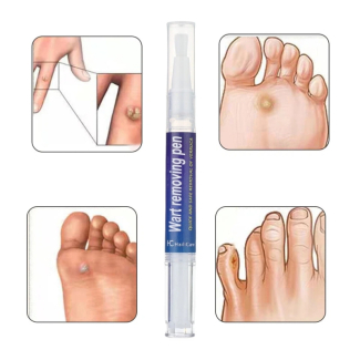 Warts Liquid Pen for Women - Effective Skin Mole and Black Dot Remover Price in Pakistan | LAPTAB