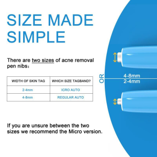 Skin Tag Remover - Safe, Natural, and Easy Home Treatment for All Areas Price in Pakistan | LAPTAB