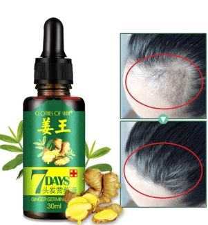 Ginger Hair Growth Essence Serum for Thicker, Healthier Hair Growth Price in Pakistan | LAPTAB