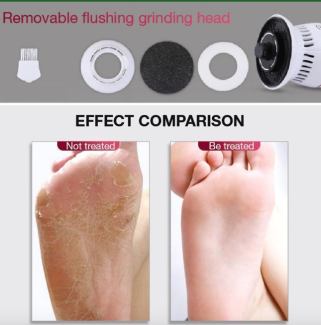 Callus Remover with Built-In Vacuum - Portable Electric Foot Grinder Price in Pakistan | LAPTAB